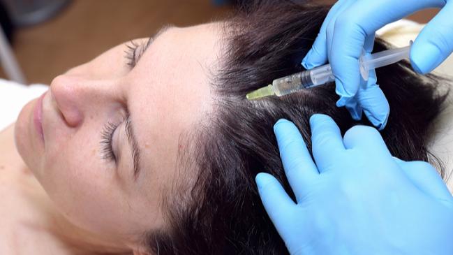 Alopecia Areata : British Association of Dermatologists Guidelines 2012
