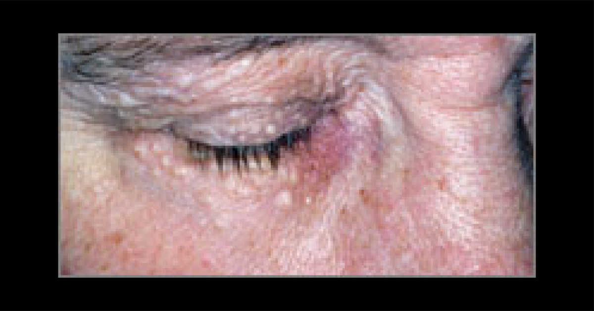 Identify The Condition