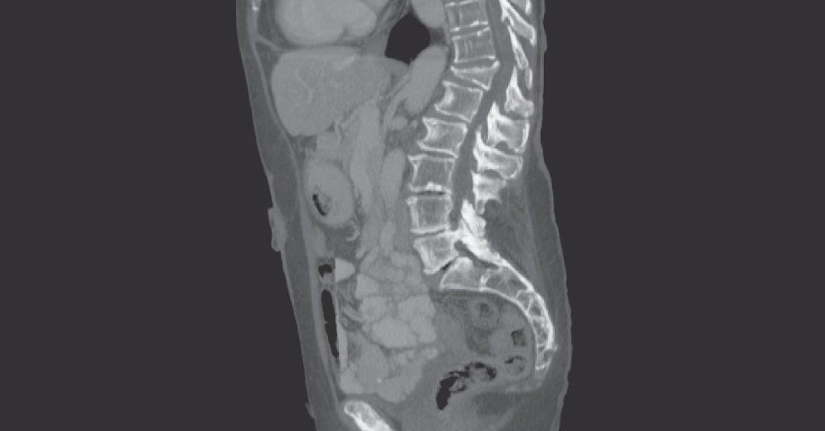 Diagnose from Radiograph