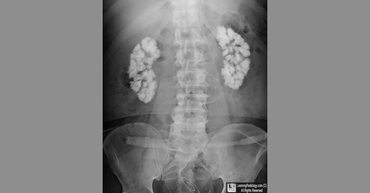 Spot The Condition