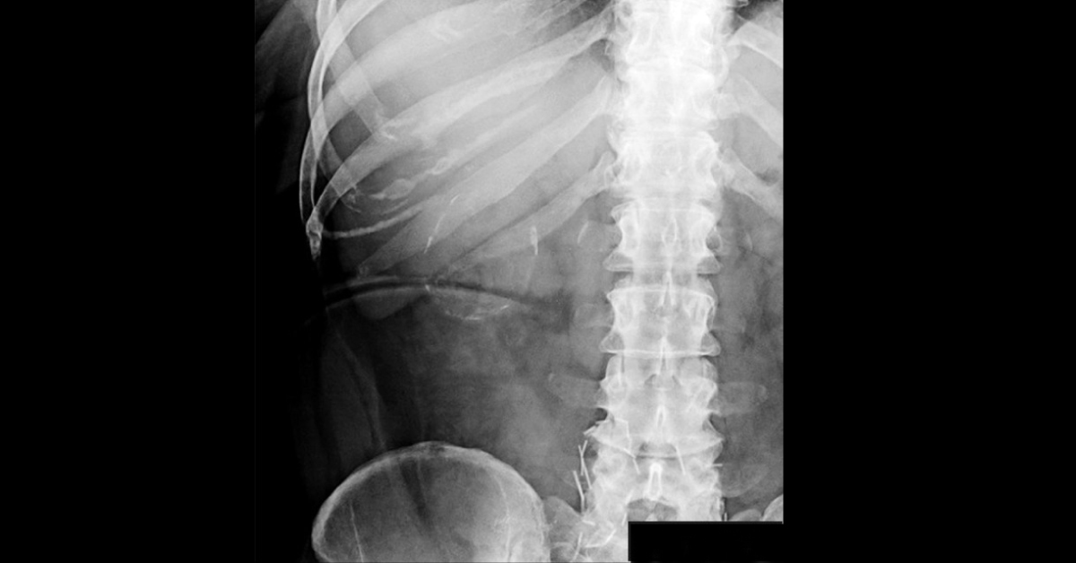 Diagnose The Vague Pain