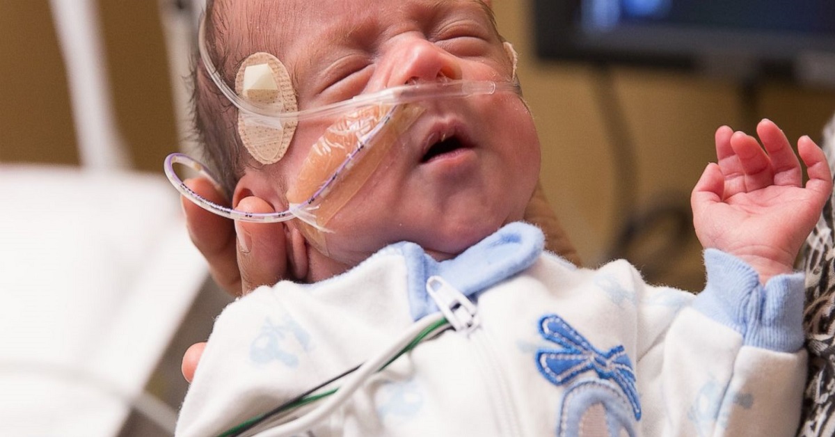 Is Brain Death Diagnosis In Newborns Practicable