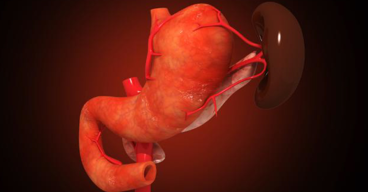 Total Pancreatectomy For Primary Pancreatic Neoplasms