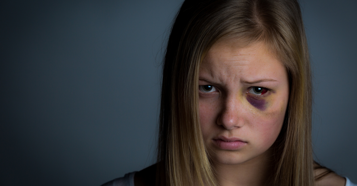 Abusive Head Trauma And Eye In Infancy : Royal College of Ophthalmologists Guidelines
