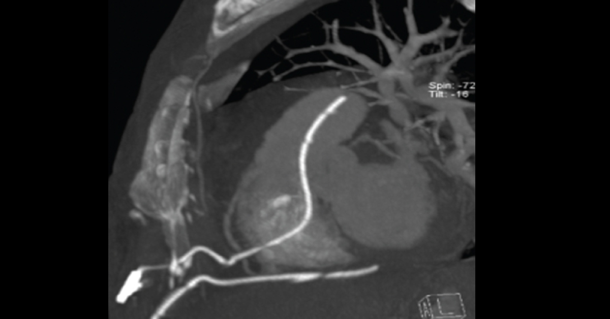 Identify The Complication During A Procedure