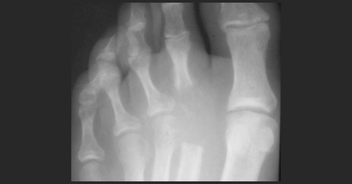 Spot The Condition