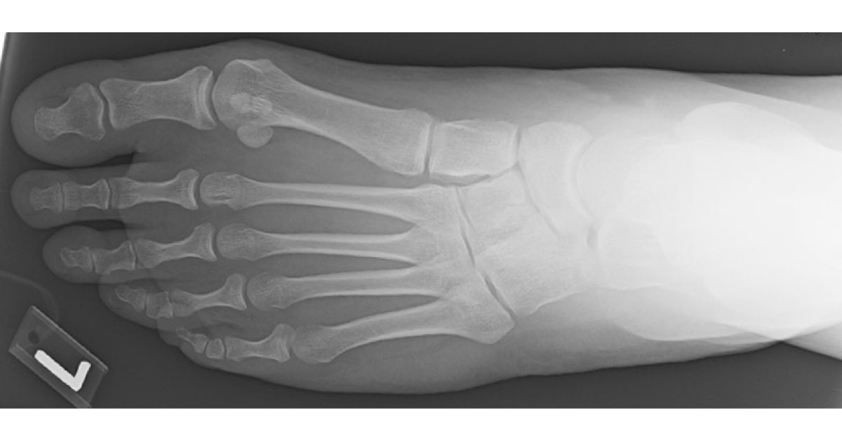 Spot The Podiatric Condition