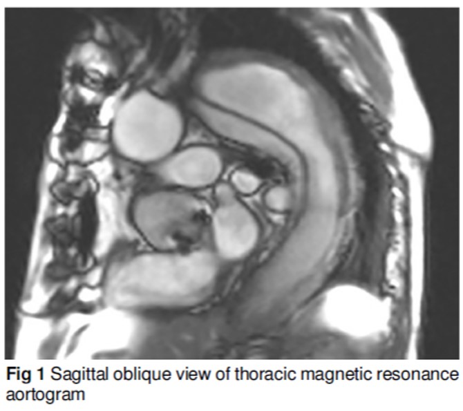 Spot The Striking Abnormality