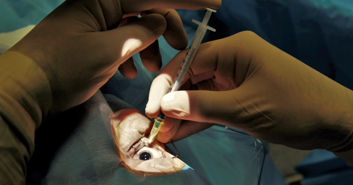 Local Anaesthesia In Ophthalmic Surgery