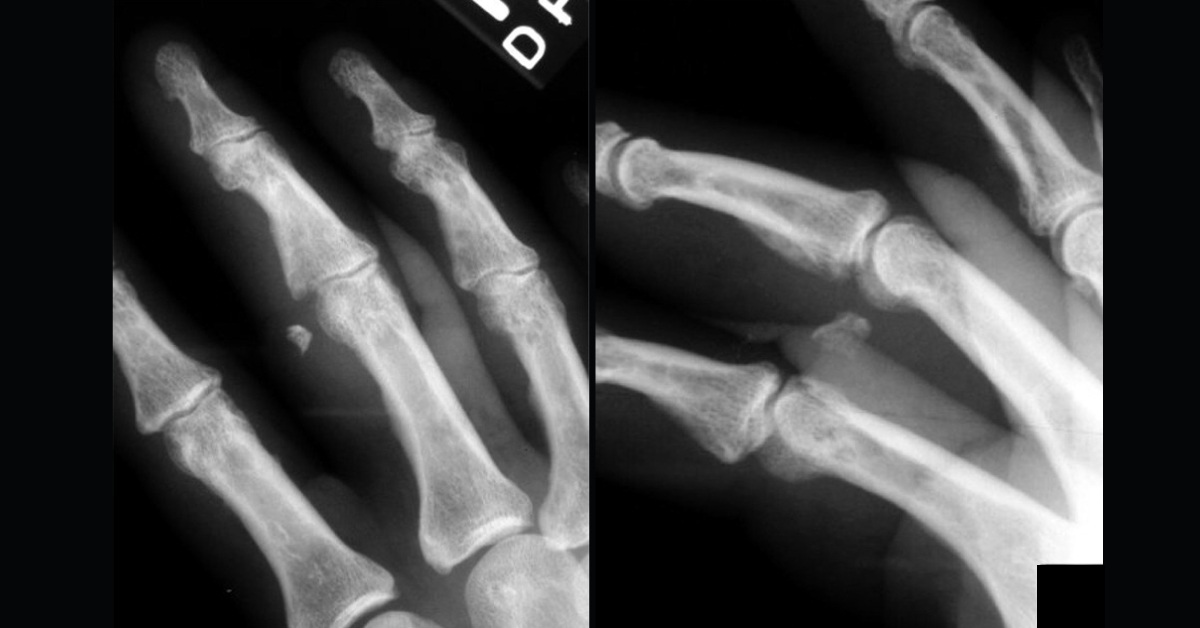 Spot This Abnormality