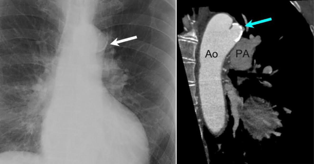 Spot the Diagnosis