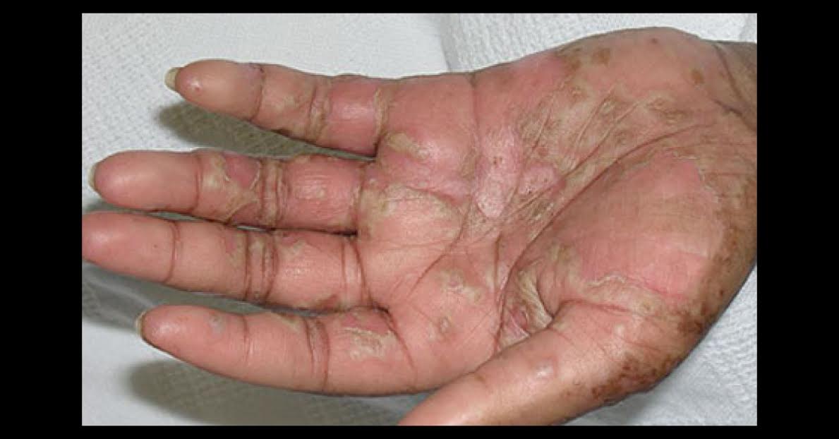 Spot The Diagnosis