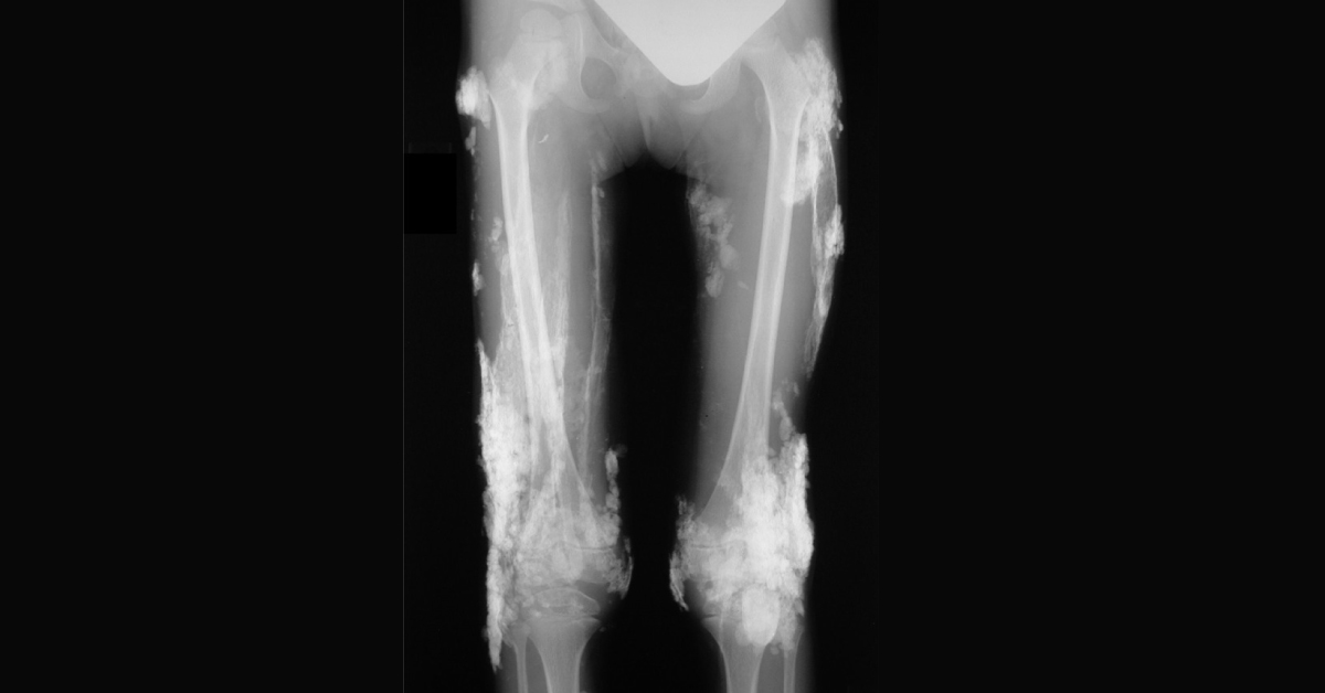 Diagnose From The Radiograph