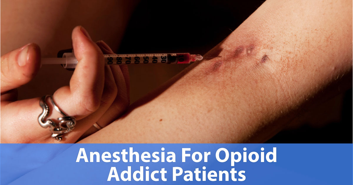 Anesthetic Considerations In Opioid Addict Patients