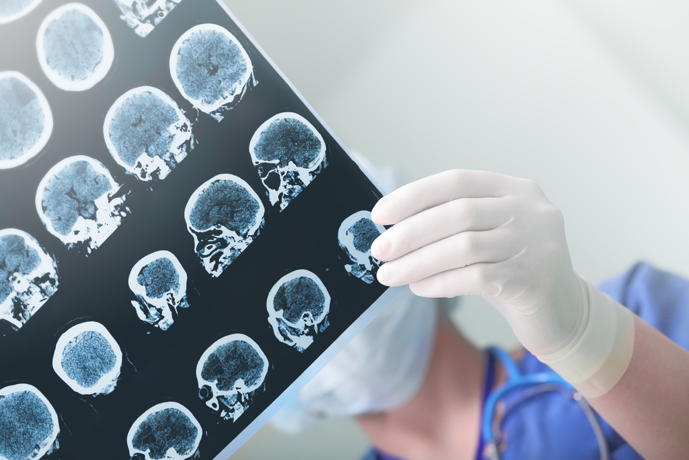 Management And New Guidelines For IGE And GES