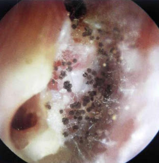 Diagnose The Ear Disorder
