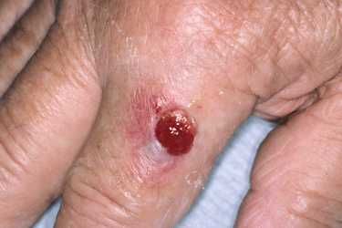 Identify The Lump
