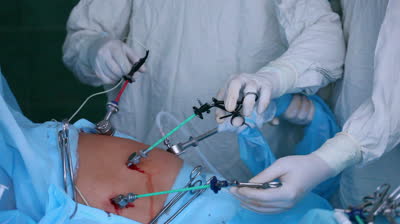 Intraabdominal Pressure During Laparoscopic And Bariatric Surgeries