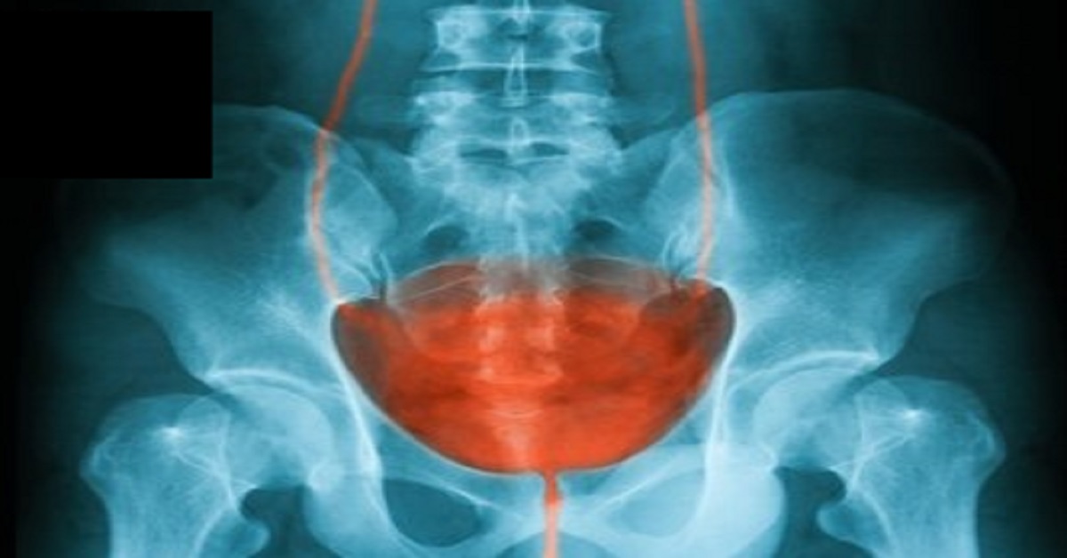 An Overview Of Urethritis In Men