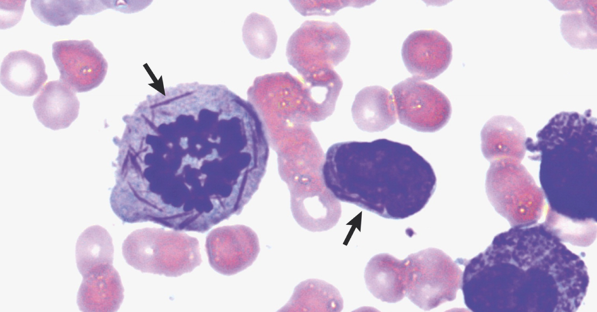 Identify This Condition From The Attached Image