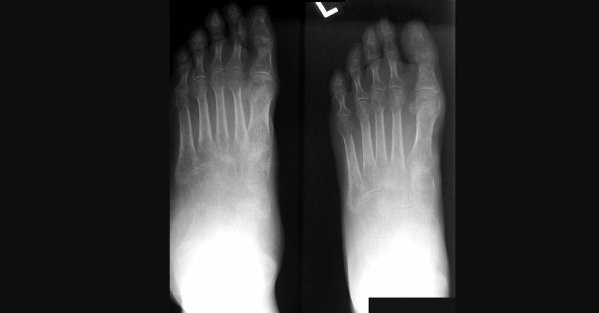 Deduce The Diagnosis For The Radiological Condition