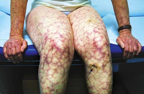 Spot The Medical Condition