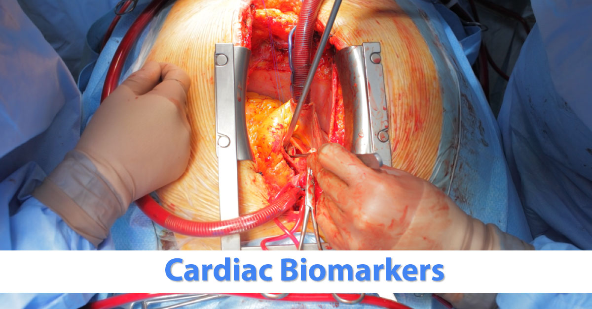 Cardiac Surgery And Potential Biomarkers