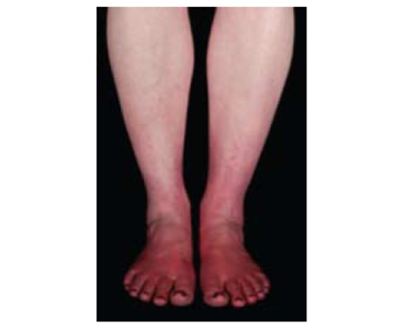 Suggest The Next Diagnostic Test