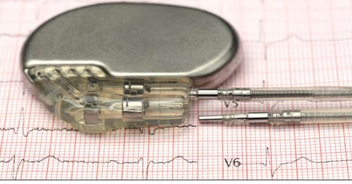 Soon Battery Free Medical Implants Powered By Bodys Fluids