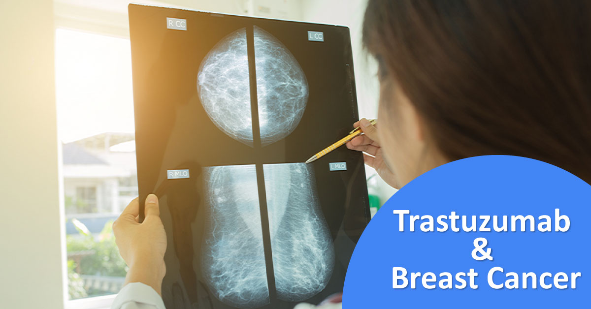 Trastuzumab In HER2 Positive Early Breast Cancer, 11 Years Follow-Up