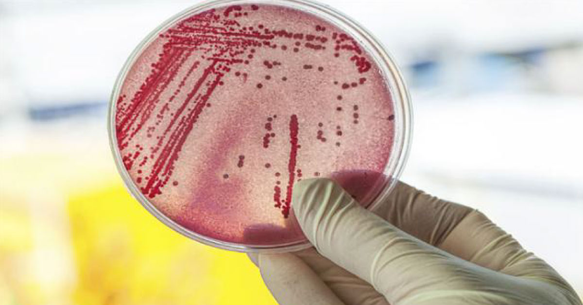 Antibiotic resistant Superbugs Evolved Even Before Dinosaurs