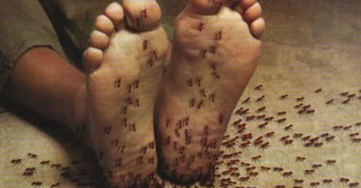 What Is Burning Pain Or Tingling Sensation In Hands Or Feet