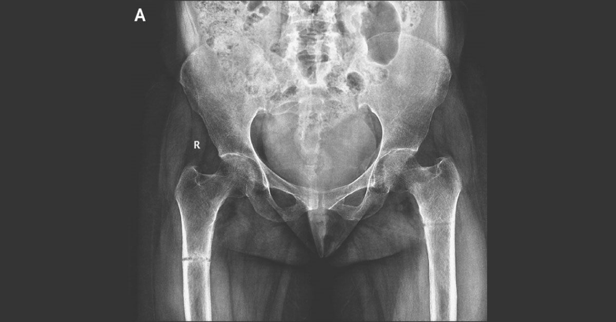 Identify This Orthopedic Condition
