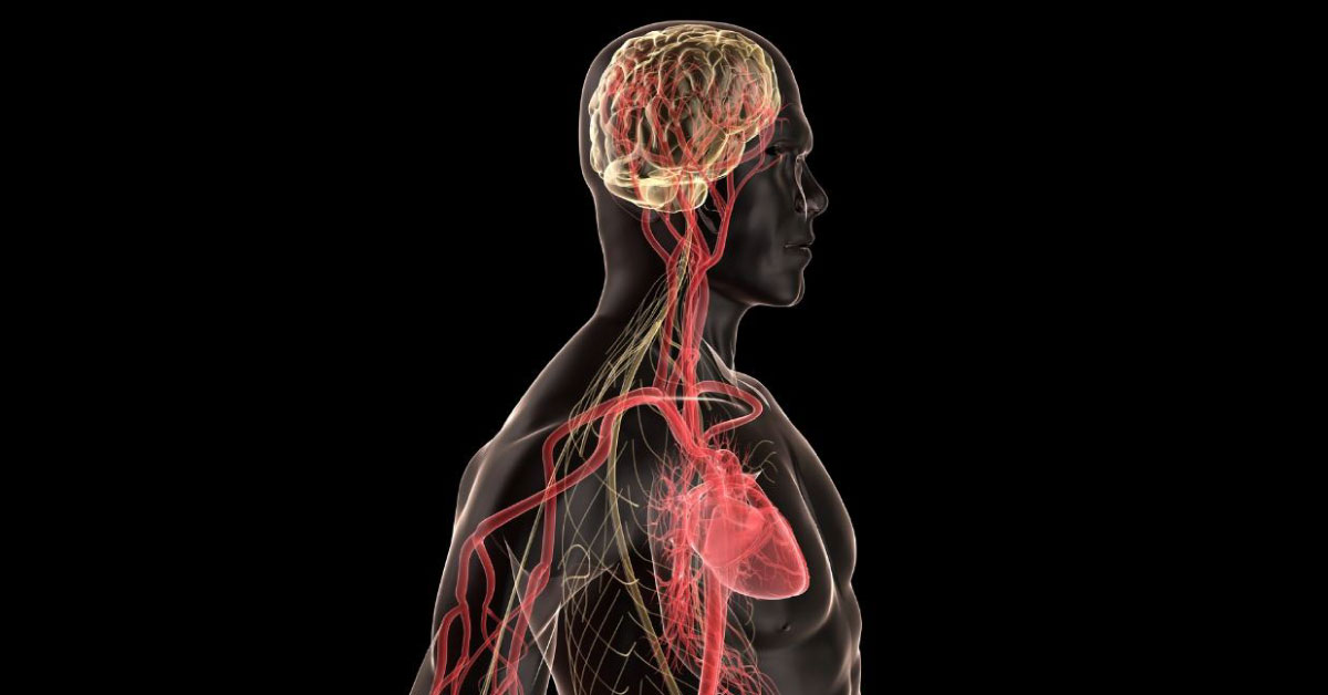Wolf Parkinson White Syndrome