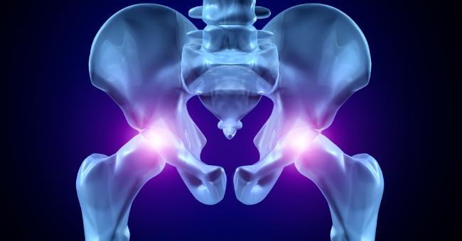 Hip Fracture In Elderly: Scottish Intercollegiate Guidelines 2009