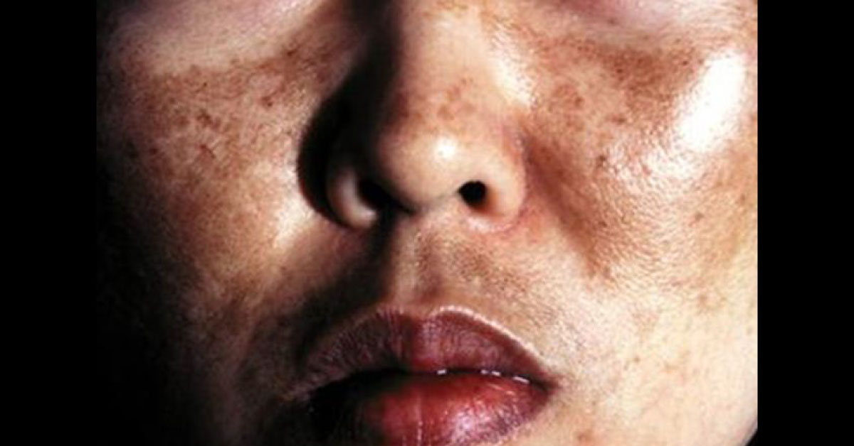 Diagnose The Lesion