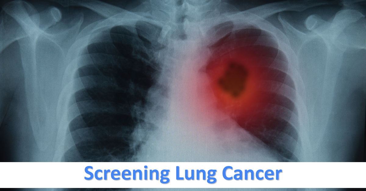 Lung Cancer Screening, Issues And Recommendations