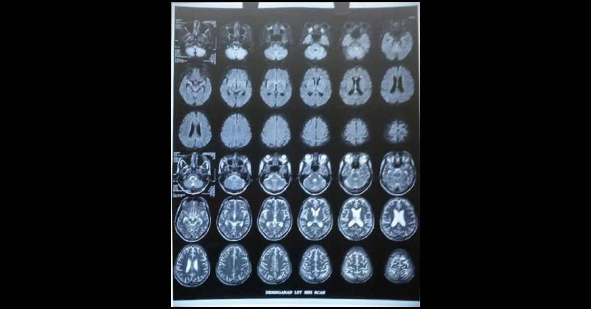 What Could Be The Diagnosis