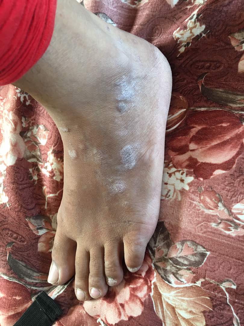 Diagnose The Skin Problem