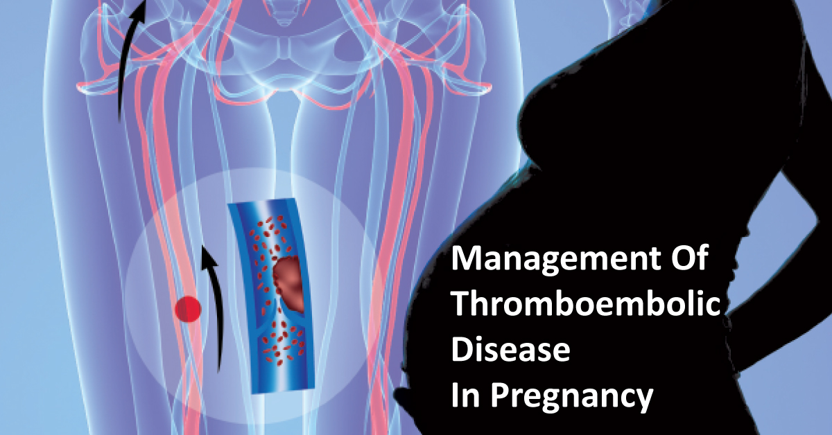 Thromboembolic Disease In Pregnancy : RCOG Guidelines