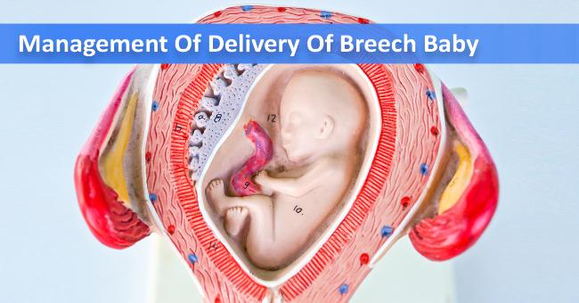 Breech Presentation Management: RCOG Guidelines 2006