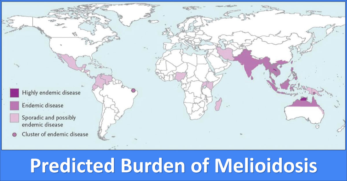 Clinical Impact Of Melioidosis, An Upcoming Transmittable Disease Of Rural India