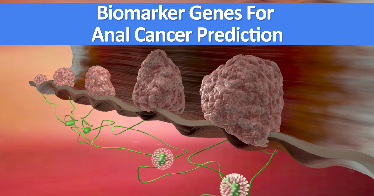 Two Biomarker Genes May Predict Cancerous Anal Lesions