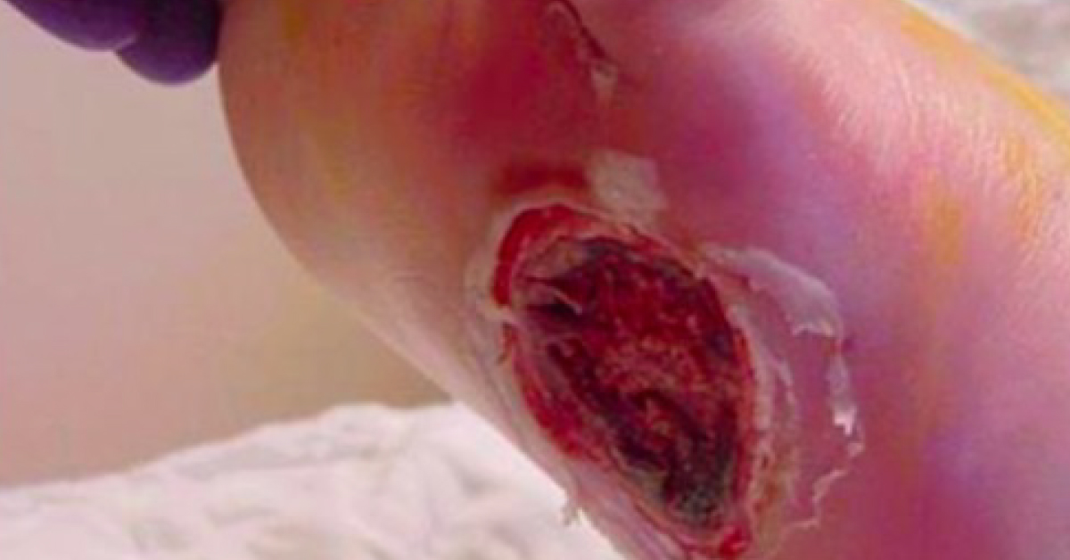 Identify The Dermal Condition