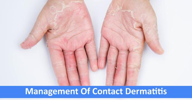 Contact Dermatitis: British Journal of Dermatology Guidelines