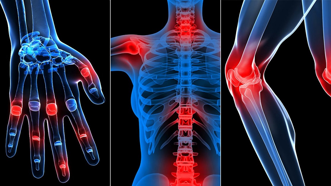 Imaging Techniques In Rheumatology