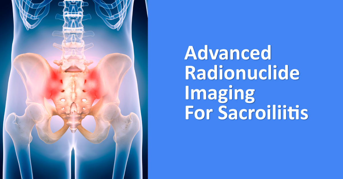 Radionuclide Diagnosis Of Sacroiliitis In Spondyloarthritis Patients