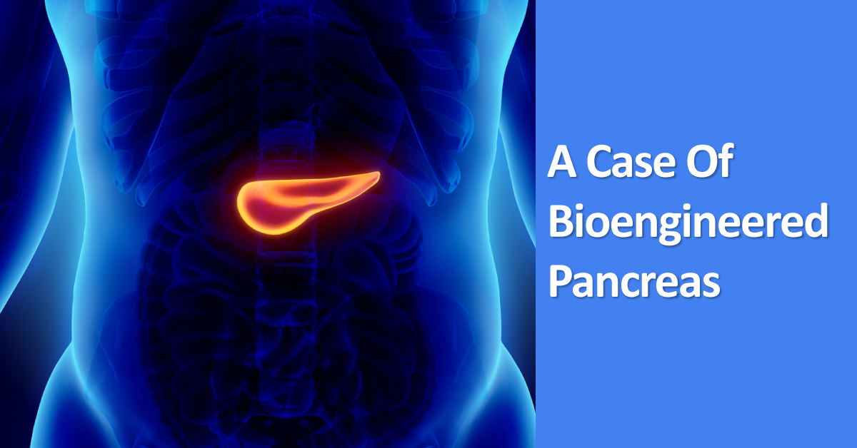 A Case Of Bioengineered Endocrine Pancreas