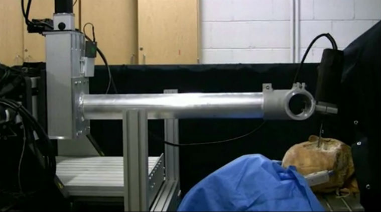 Robotic Drill Makes Neurosurgery 50 Times Faster