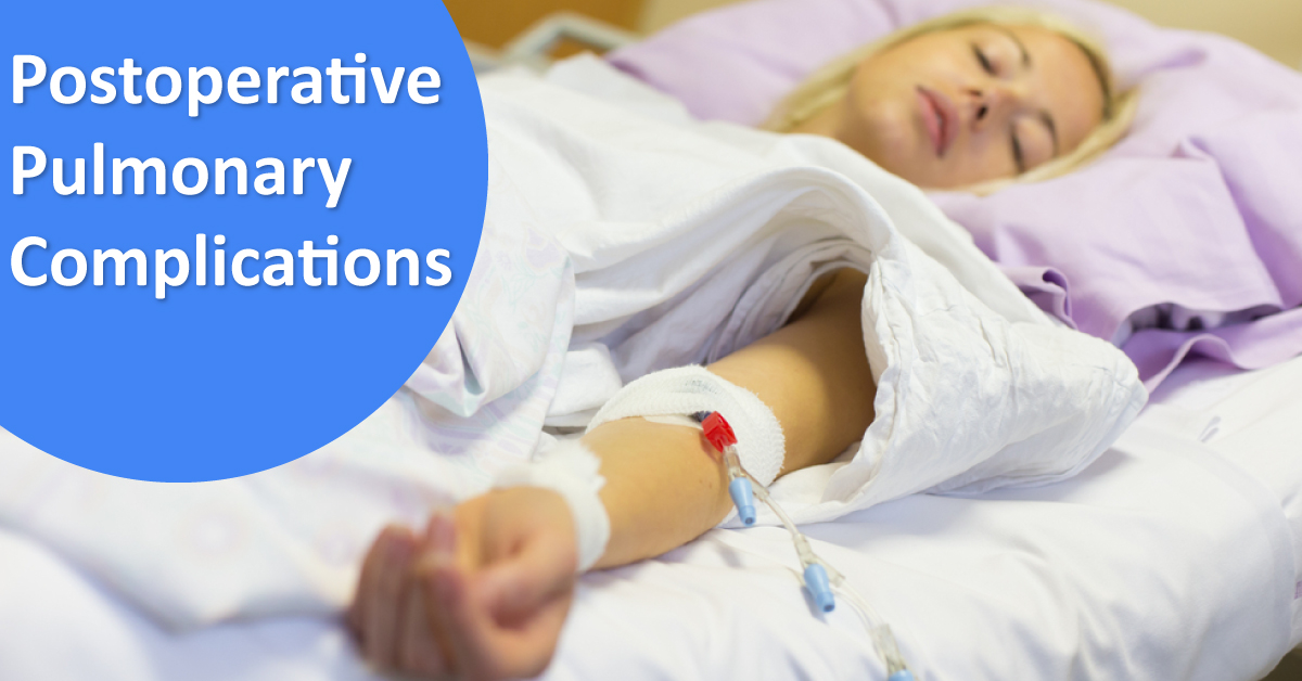 Assessing Postoperative Pulmonary Complications